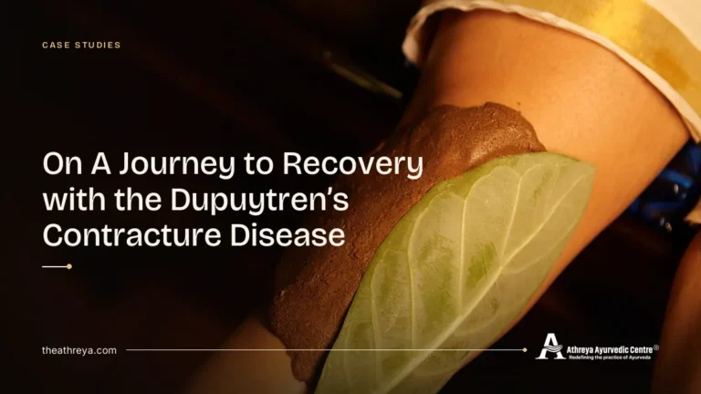 On a journey to recovery with Dupuytren's contracture